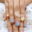 롯데리아 삼송신원점 | 프리미엄통젤 시술 입니다~^^