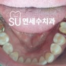 터 치과기공소 이미지
