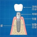 수정기공사 이미지