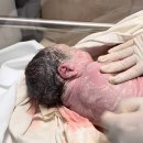 (주)한빛케어 | [38+1] 한빛여성병원 제왕절개 1-2일차 후기