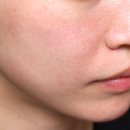 서울여의도초등학교 | 여의도피부과 세르프 600샷 후기｜피부과 유목민이 10년 만에 정착한 이유