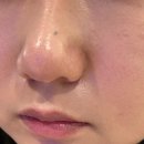 다남미용실 | 호평동피부관리 추천! 블랙헤드 코피다 남양주점에서 모공 케어 받은 후기