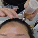 이플뷰티 | 이플뷰티 두피케어 평택 헤드스파 받고 온 후기