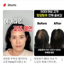 도트랩