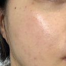 티피앤코 이미지