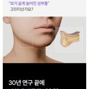 집에서 즐기는 탄력 관리, 장나라 홈케어템 이오에이 풀쎄라 PRO 솔직 사용 후기 (가정용 하이푸 디바이스)