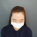 채우다서울강서 | 헤어라인 M자 탈모. 헤어라인 교정. 채우다서울강서