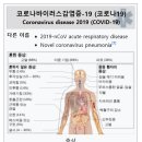 코로나바이러스감염증-19 증상과 백신 개발!