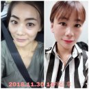 이혈테라피 이미지