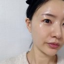피부재생 홈케어의 끝, 디플셀 인퓨전프로그램