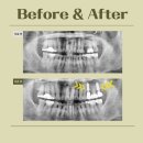 더플랜트치과의원 이미지