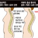 거북목(일자목) 증후군 이미지