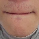 에이치봄의원 이미지