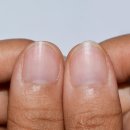손톱 - 영도구 조내기로 38 | 손톱
