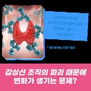 갑상선 기능 저하증, 초기 증상과 관리 방법을 알아보세요! [갑상선 기능 저하증 검사]