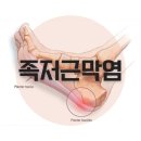 루케테 이미지
