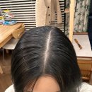 대전 정수리 탈모 고민일 땐 페이스 디자인