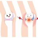 인생을 최후까지 즐기기 위한 무릎의 통증과의 교제방법 이미지