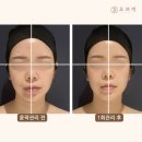 마곡윤곽관리 마곡에스테틱 추천 오브미 마곡본점(작은얼굴관리 후기)