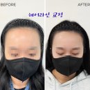 채우림뷰티 이미지