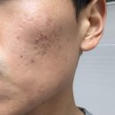 풀림한의원 | ⭐청주 복대동 문제성피부 관리｜이룸에스테틱 웨딩·멘즈케어 1:1 맞춤관리 후기