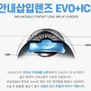빛안과 네이버블로그