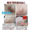 누가건강기능식품