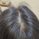 미우잉크 | 머리숱 고민 끝! ‘미우아카데미 라인’에서 받은...SMP로 풍성하고 자연스러운 헤어라인 찾은 솔직 후기