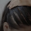 한들식품 | 정수리 탈모 영양제만 먹는다고 해결될까? 대구 수성구 올브의 솔직한 답변