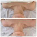 다올 | 대전 도룡동 피부 바디관리, 다올에스테틱 알포유테라피 후기