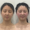 도도에스테틱 - 용인시 기흥구 | 평택피부관리 고덕동 도도에스테틱 알테온 윤곽 후기