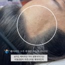 헤어보정# 이미지