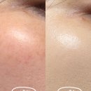 age21 | [애경] 기미쿠션 추천 AGE20'S 멜라닌샷 쿠션 21호 커버력좋은 홈쇼핑템 후기