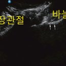 NR-30[달구벌대로]-하-56 | 대구천장관절염| 이런 경우 의심하고...OOO치료 해 보자.