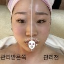 홍대피부관리 추천 곽유정에스테틱 리프팅 제대로!! 받고 온 후기