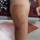 노약국 | 약국 멍크림 벤트플라겔 베노플러스겔 노브루겔 후기