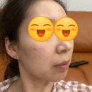 남다름뷰티 | 광명 피부관리 :: 안젤라뷰티스파 피부관리받고 왔어요~