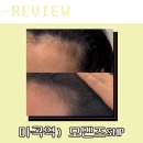 하나로1차 | 회사 퇴근길에 들른 마곡두피관리, 모멘즈SMP 여성동안헤어라인 1차 후기_마곡탈모