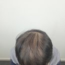 하프톤 스칼프 이미지