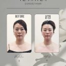 루원시티피부관리 동안 리프팅 두피관리 바로 REMEDY 루원시티점