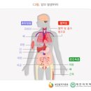 우리 몸의 암 발생부위와 발생기전 이미지