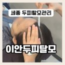 세종시두피케어 추천 이안두피탈모 대만족 후기