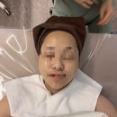 광진산소 | 광진구 강변 피부관리 피부 압출+ 수분관리까지 받고 온 예지에스테틱 솔직후기
