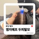 영양쎈타 분당점 | 분당 탈모 | 야탑 두피관리샵 엠지에프두피탈모전문센터 문제성+헤드스파 관리 과정 솔직 후기