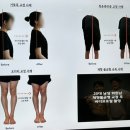 [부평 다모아체형교정센터 방문 후기] 자세교정 &amp; 허리통증 관리 받았어요!
