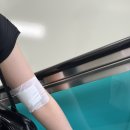 내돈내산 레터링 타투/문신 1회차 제거 후기 | 병원 정보는 댓글