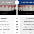 새로치과기공소 이미지