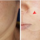 메타바이오 이미지