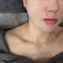 성북구 동덕여대 피부관리 타라테라피 플라즈마 근막관리 후기