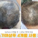 송창훈내과의원 네이버블로그